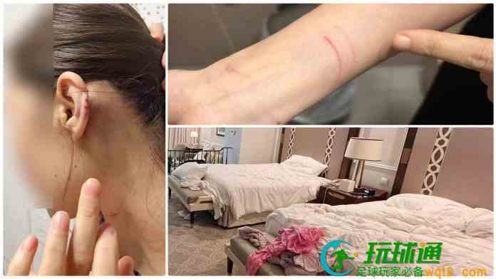 無業漢1小時內先在酒店房姦劫女賭友 再扮換錢黨毆劫兩女終落網 無業漢1小時內先在酒店房姦劫女賭友 再扮換錢黨毆劫兩女終落網